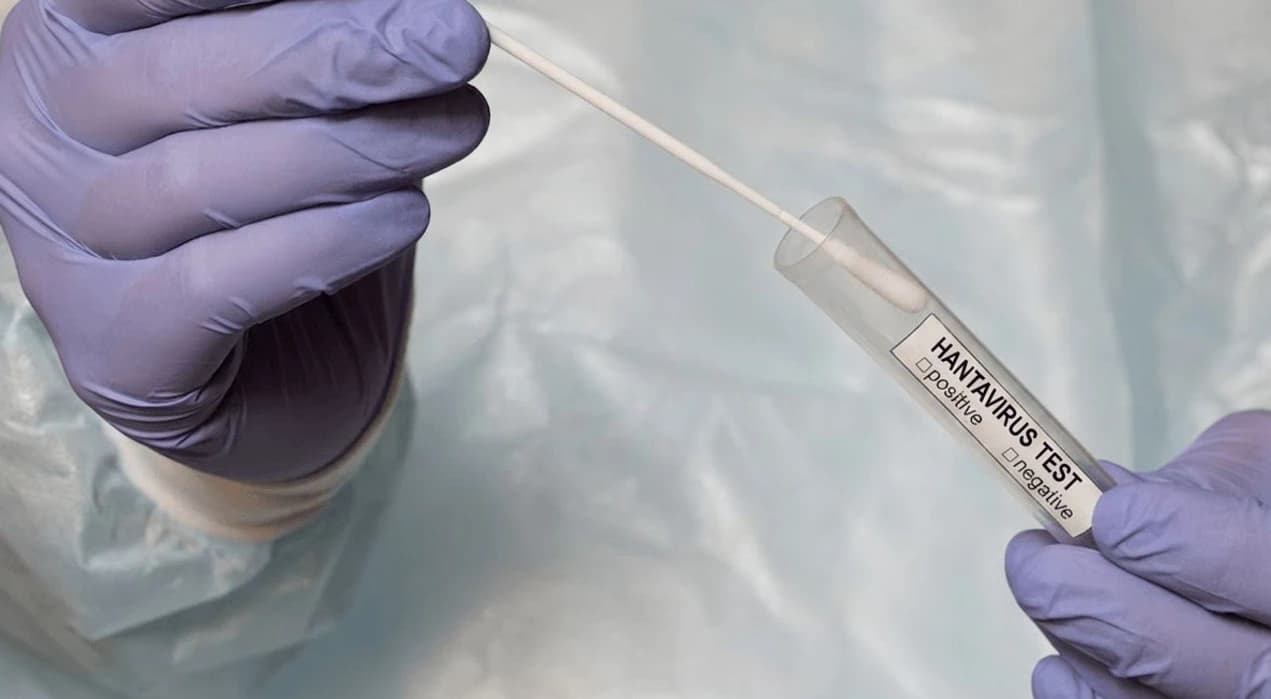 Hantavirus