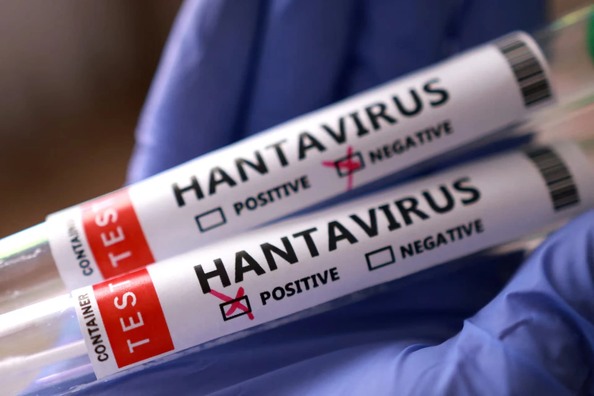 Ghana: las autoridades refuerzan las medidas preventivas ante un posible brote del Hantavirus