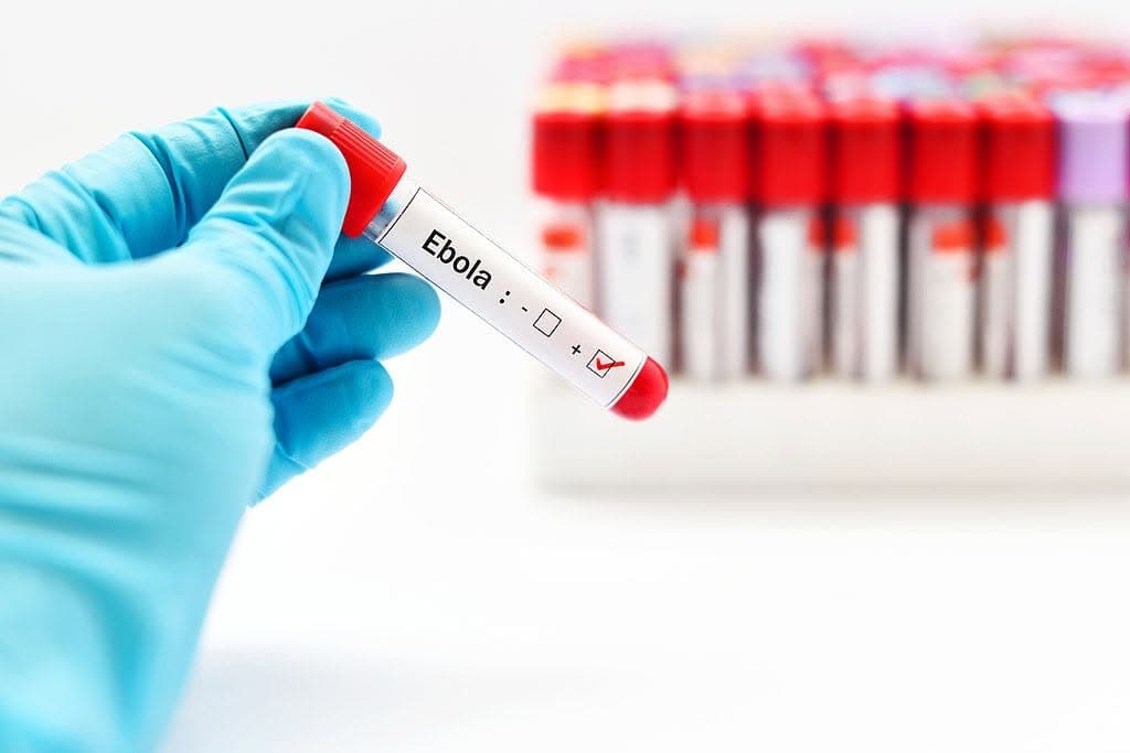Ébola en la RDC sigue avanzando con más de 2.400 casos registrados